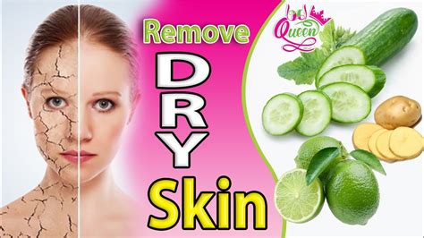 How To Remove Dry Skin On Face কি ভাবে শুস্ক স্কিন দুর করবেন Youtube