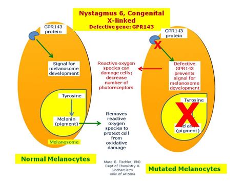 Nystagmus 6 Congenital X Linked Hereditary Ocular Diseases