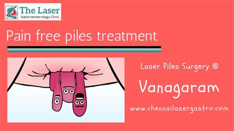 Piles Treatment In Vanagaram Is Now Pain Free Chennai Laser Gastro Clinic
