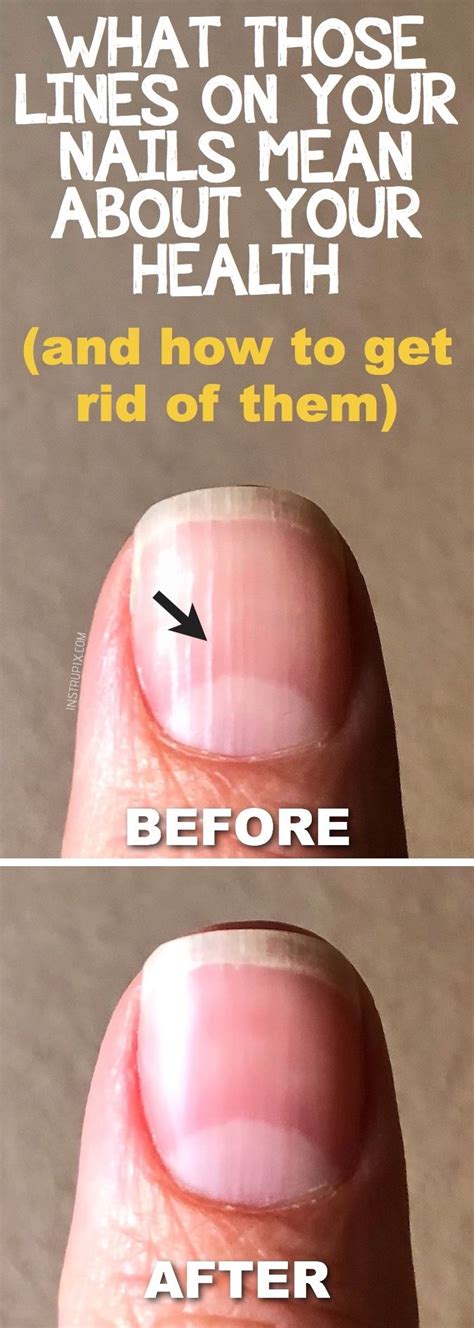 Cool White Line Vertical On Nail References Fsabd42