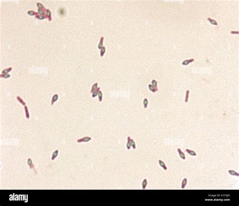 Clostridium Botulinum Spores Stained With Malachite Green Stain The