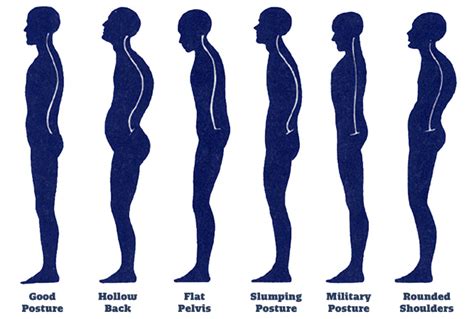 why does posture matter body one physical therapy