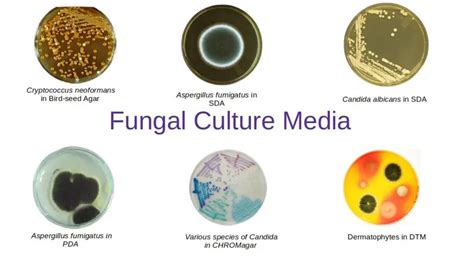 Common Fungal Culture Media Their Uses • Microbe Online