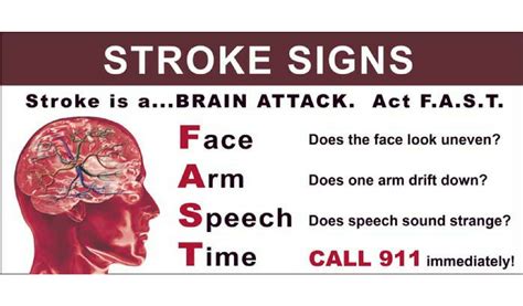 What Is A Stroke And Whats The Warning Signs Hc Training