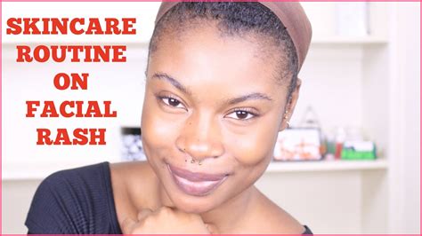 Skincare Routine Quick Way To Get Rid Of Rash Youtube