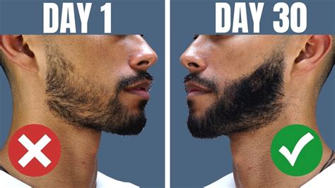 can every guy grow a beard