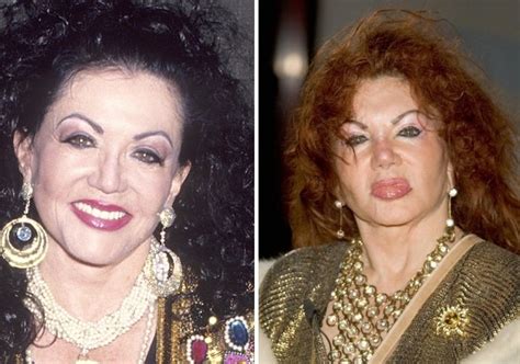 Jacqueline Stallone Before And After Plastic Surgery