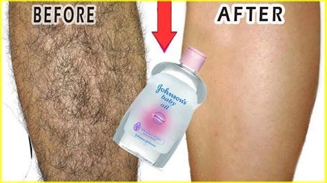 How to remove hair from your upper lip naturally. In 3 Days Remove Unwanted Hair Permanently, No shave No ...