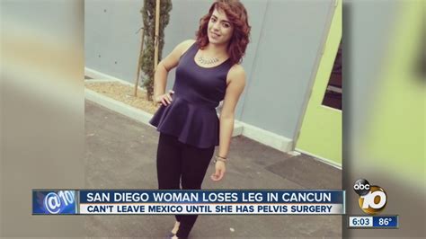 San Diego Woman Loses Leg In Cancun Accident Youtube