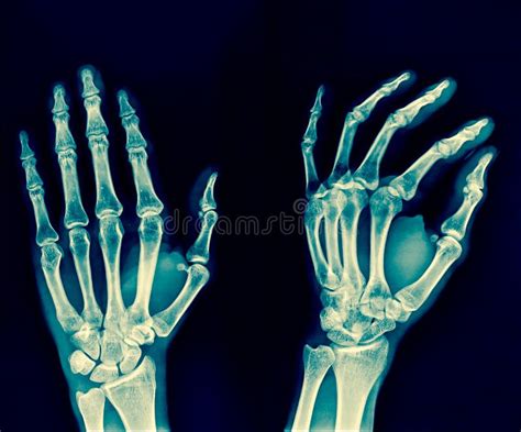 Normal Human S Hands Stock Image Image Of Healthcare 37784415