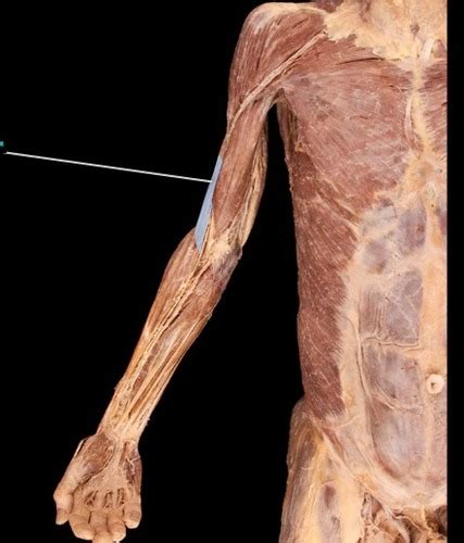 Human Anatomy Cadaver Muscle Pics From Pal 30 Flashcards Quizlet