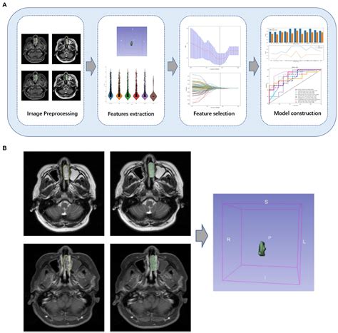 Frontiers A New Biomarker Combining Multimodal Mri Radiomics And
