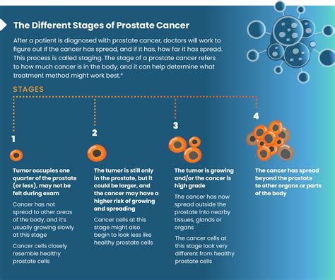 Prostate Cancer Factsheet Camcevi