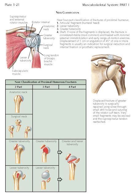 Proximal Humeral Fractures Neer Classification Fractures Of The