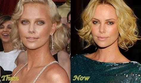 Charlize Theron Before And After Plastic Surgery 8 Celebrity