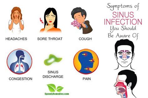symptoms of sinus infection you should be aware of speedy remedies