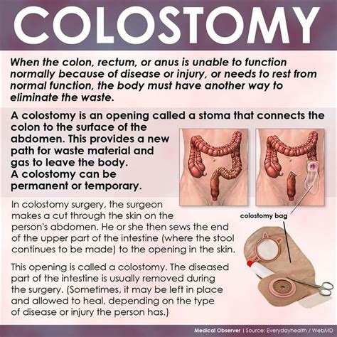 What Is A Colostomy Nursing Tips Colostomy Health Tips