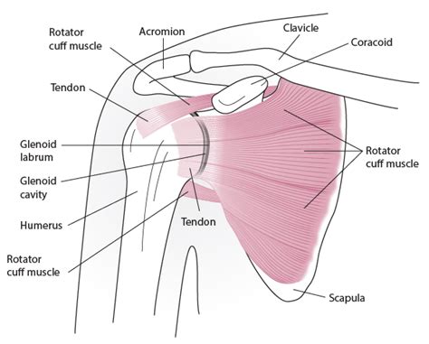 This procedure involves the removal of the fluid with a needle and syringe under sterile conditions and can be performed in the doctor's office. Rotator Cuff Injury/Subacromial Bursitis - Injuries and Poisoning - MSD Manual Consumer Version