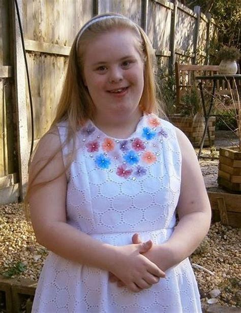 pin on down s syndrome in the news