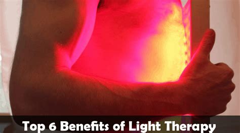Top 6 Benefits Of Light Therapy