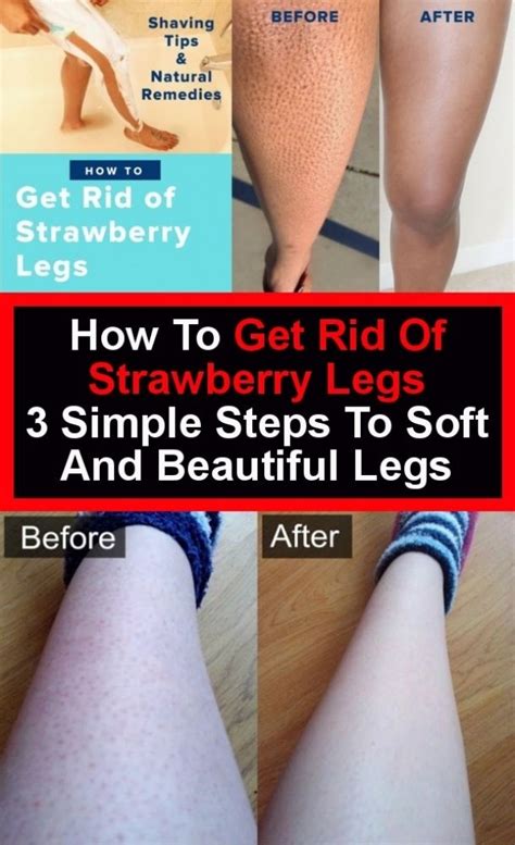How To Get Rid Of Strawberry Legs Three Simple Steps In 2020