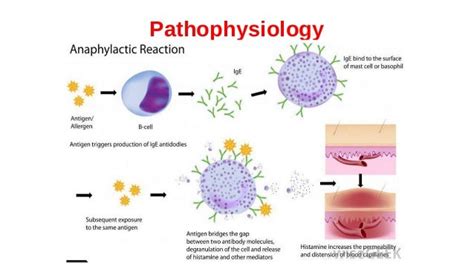 Pathophysiology Of Anaphylactic Shock