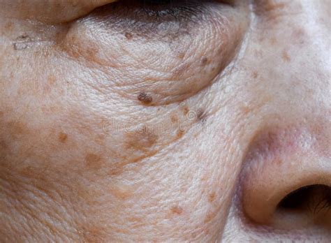 147 Aging Woman Sun Damage Stock Photos Free And Royalty Free Stock