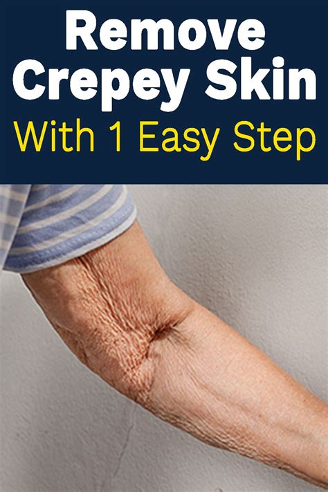 How To Fix Crepey Skin On Neck Jody Schultz News