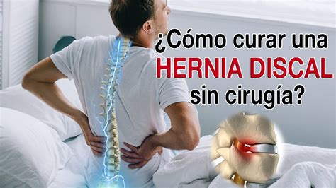 What Is A Lumbar Hernia