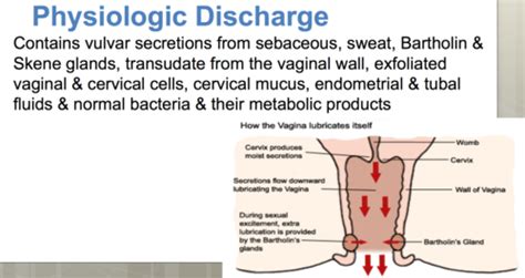 Vaginal Dischargediscomfort Flashcards Quizlet