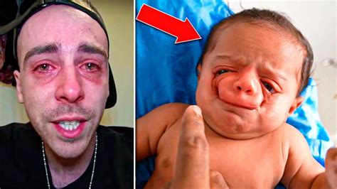 Dad Is Horrified Seeing Newborn Son He Doesnt Look Like A Person
