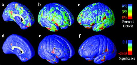 Structural Abnormalities In The Brains Of Human Subjects Who Use