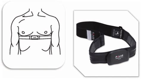 Placement Of The Belt On The Patient Download Scientific Diagram