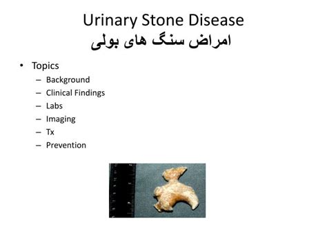 Ppt Urinary Stone Disease امراض سنگ های بولی Powerpoint Presentation