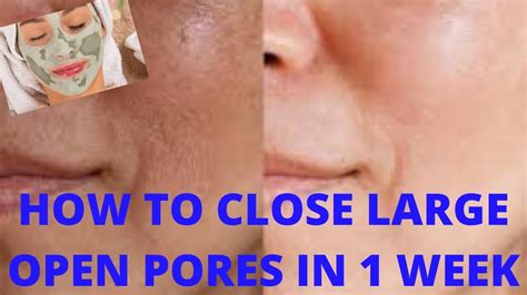 How To Repair Damaged Skin Close Large Open Pores In 1 Week