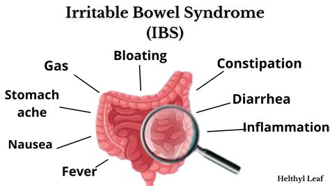 Irritable Bowel Syndrome Ibs And Its Treatment Helthy Leaf