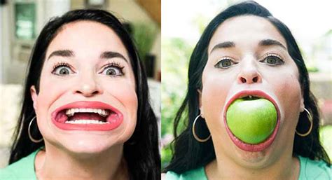 Watch This Woman Breaks Records For Having The Worlds Largest Mouth Telangana Today