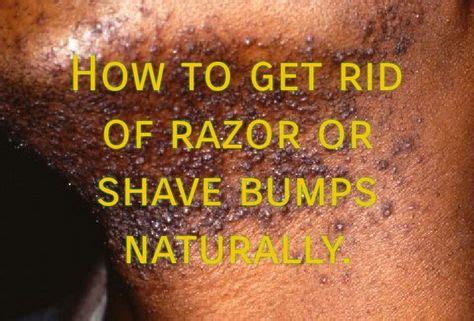 Top Shaving Bumps Ideas And Inspiration