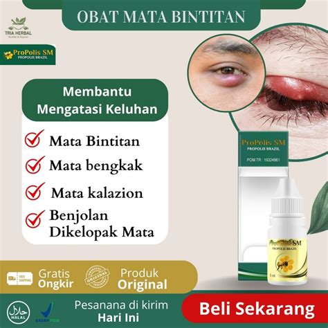 Jual Obat Mata Bintitan Obat Mata Bengkak Obat Mata Kalazion Obat