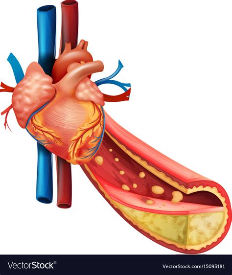 Diagram Showing Human Heart And Fat Veins Vector Image