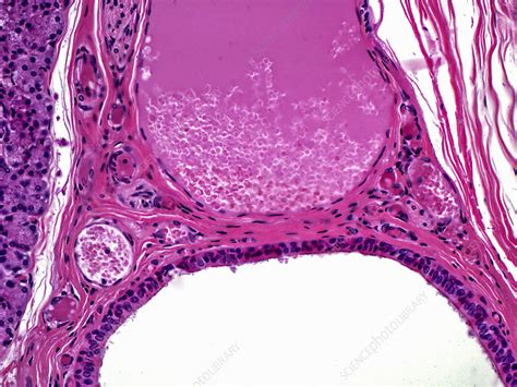 Parotid Gland Lm Stock Image C0305188 Science Photo Library