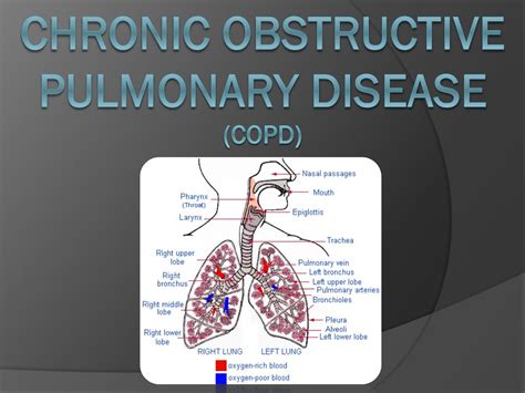 ppt chronic obstructive pulmonary disease copd powerpoint presentation id 3152452