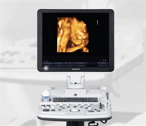 Samsung Sonoace R7 Obstetrics Gynecology Ultrasound System At Best