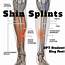 Shin Splints  Who It Affects The Most And Why Cawley Physical Therapy