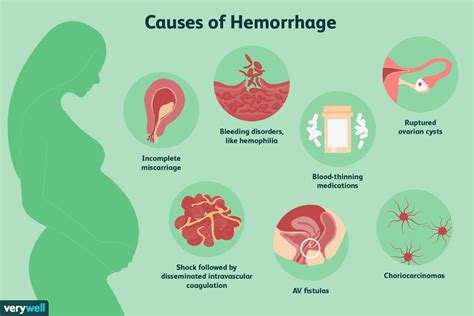 How To Know If Youre Hemorrhaging Due To A Miscarriage