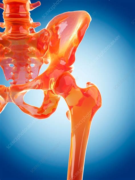 Human Hip Joint Stock Image F0162828 Science Photo Library