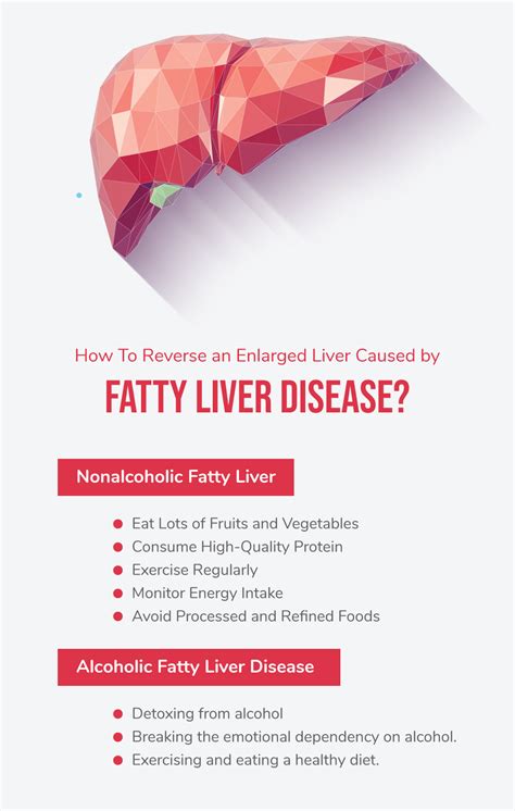 What You Need To Know About An Enlarged Liver Fatty Liver Disease