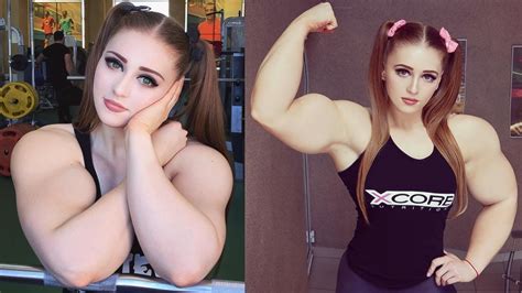 Perioperatív időszak járdaszegély kockázat bodybuilder barbi Nyel