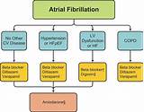 Atrial Fibrillation Treatment Guidelines 2017