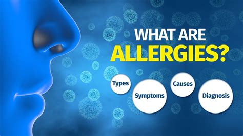 What Are Allergies Types Symptoms Causes Diagnosis Youtube